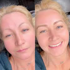 It's great to see my clients beautiful smiles again 😊🔥 . . . . . . . . .  . . . #microblading #microbladingbrows #microneedling #semipermanentbrows  #cosmetics #ottawa #cosmetictattoo #microbladingeyebrows  #microbladingottawa #ottawamicroblading #