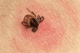 And here's when you should see a doctor. Get The Facts On Tick Bites On Humans Terminix