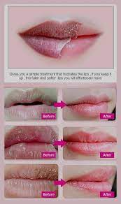 Pin By נעמי כהן לביא On שרוכים In 2022 | Soft Lips, Natural Hair Mask, Pink  Lips