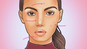 this acne chart will tell you why youre breaking out