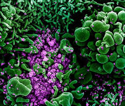 Hun rol bij het optreden van voedselinfecties wordt steeds duidelijker, omdat ze tegenwoordig beter kunnen worden aangetoond. Oorsprong En Evolutie Van Virussen Nemo Kennislink