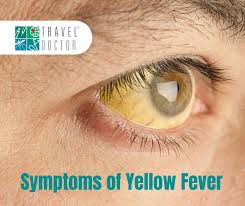 Image result for Yellow Fever