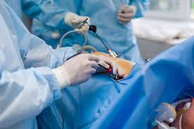 Sejumlah komplikasi serius mengintai penderita penyakit batu ginjal. Operasi Angkat Kandung Empedu Dengan Laparoskopi Ini Yang Harus Anda Ketahui Alodokter