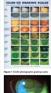 pdf essential contact lens practice semantic scholar