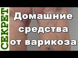 как избавиться от сосудистой сетки на ногах в домашних условиях Eti Naturalnye Sredstva Pomogut Bystro Izbavitsya Ot Varikoznogo Rasshireniya Ven I Sosudistoj Setki Na Nogah 1 Gel Varikoz Domashnee Lechenie Zhurnal O Zdorove