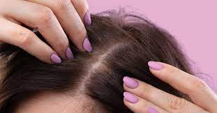 The method for applying hair loss shampoo is the same as regular shampoo, i.e., you apply it to wet hair, massage it into the scalp and rinse it. The Best Shampoos For Thinning Hair And Hair Loss 2019