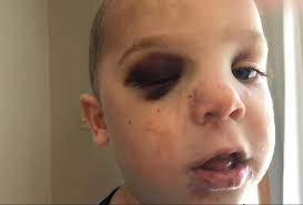 Roscoe family gives back to Mercyhealth after 3-year-old's sledding accident