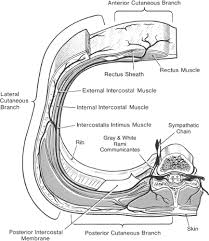 Image result for Intrapleural Anesthesia
