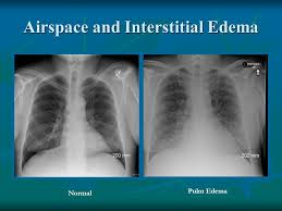 Back To Basics Radiology Ppt Video Online Download
