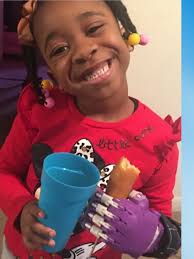 Answered prayer': Jasper County kindergarten student gifted 3D printed  prosthetic hand