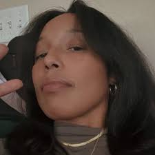 I have nothing against lip filler but if you have a cupids bow (not many  people do) keep it! People are sandblasting beautiful lip structure!