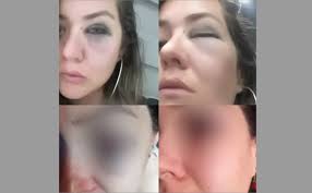 Periodista fue brutalmente agredida por denunciar robo