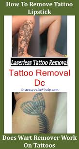 Laser tattoo removal (most popular and best tattoo removal method). Tattoo Removal London Foot Tattoo Removal Before And After New Laser Tattoo Removal Can Laser Hair Removal Work Laser Tattoo Tattoo Removal Cost Tattoo Removal