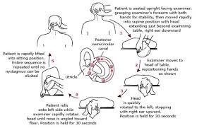 The epley maneuver, however, can dislodge these crystals and remove them from the semicircular canals. Epley Maneuver Pi