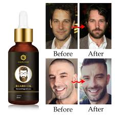 First, we will understand the reasons you are facing the beard hair loss, and then we will move on to some potential solution for the same. Beard Growth Oil Enhancer Natural Organic For Men Beard Growth Anti Hair Loss Products Facial Nutrition Moustache Grow Beard Hair Loss Products Aliexpress
