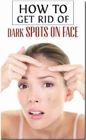 How Do I Get Rid Of A Pimple Overnight Finest Way To Get Rid Of Acne Overnight Find Out How To Remove Spots On Face Black Spots On Face