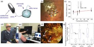 Reich l, szwed m, cohen l, amedi a (2011) a ventral visual stream reading center independent of visual experience. Osa Implantation Of Electronic Visual Prosthesis For Blindness Restoration