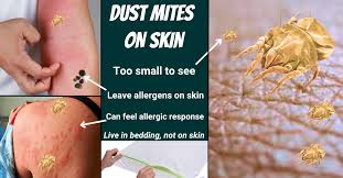 Image result for Dust mite
