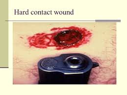 If you must know, google 50 cal bmg wounds. Ballistics And Explosives Ppt Download