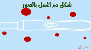 شكل دم الحمل بالصور الحمل والولادة ماميز بيبي