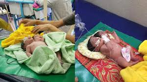 Lahiran normal kadangkala dihadapkan pada penyulit, seperti lilitan tali pusat dan distosia bahu. Tak Pernah Lakukan Usg Ibu Kaget Melahirkan Bayi Kembar Siam 1 Badan 2 Kepala Youtube