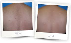 From the paramus, new jersey office of elysium aesthetics and vein care, he serves a diverse clientele from all over bergen county and surrounding communities. Total Beauty Home