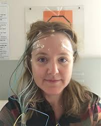 Epilepsy Action Australia...