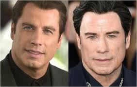 Plastic surgery can be done by any celebrities, both male and female. 15 Celebrities With The Most Plastic Surgery Sieber Plastic Surgery
