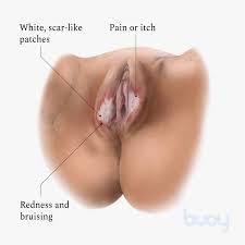 White pain anal