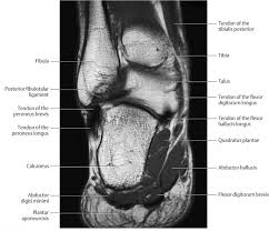 The foot contains many bones, muscles, tendons, and other structures. Ankle And Foot Radiology Key