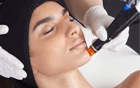 HydraFacial in Calabasas