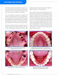 Jan 15, 2017 · furthermore, he added, “this isn’t my first, second, third, fourth, fifth, sixth, seventh seizure. How A Smile Makeover Can Change Your Life Premier Dental Omaha Ne