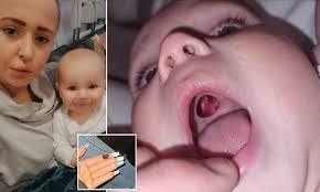 What do you call the roof of the mouth? Young Mum 24 Rushes Baby To Hospital Thinking He Had A Hole In His Mouth But It Was A Red Sticker Daily Mail Online