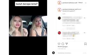 Vidio viral the connel twins terbaru. Bibir The Connell Twins Jadi Bahan Gosip Nama Lucinta Luna Ikut Terseret