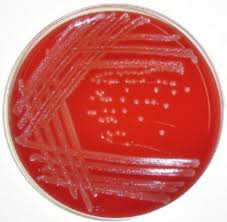 Ivanovii colonies from those of other listeria spp. Hba Plate Streaked With Listeria A Sterile Inoculating Loop Was Used Download Scientific Diagram
