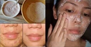 Pin On Astuces Naturelle