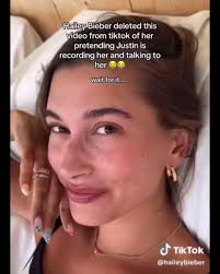 Hailey Bieber Cosa È Successo