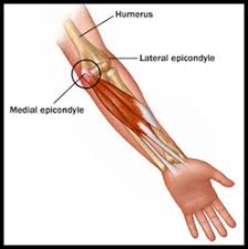 The achilles tendon is also called the calcaneal tendon. Inner Elbow Pain First Health Physical Therapy In Midtown West