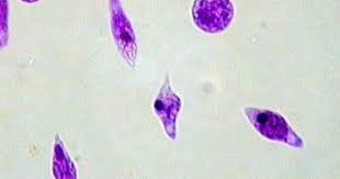 Domain Eukarya Kingdom Protista Phylum Euglenozoa Genus Euglena They S Microscopic Cells Microscopic Squish