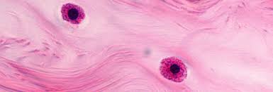 Testing for Hereditary α-Tryptasemia: