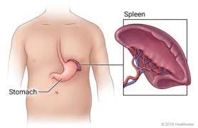 Splenectomy What To Expect At Home