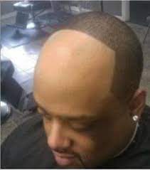 For men, the neckline is usually squared off, and the portions of the hair that are short are trimmed into a short, tapered, perimeter edge around 1/2 inch wide around the longer hair. How Much To Give Up Your Hairline Sports Hip Hop Piff The Coli