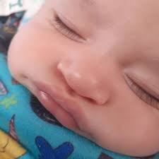 MEMORIALCARE CARDIOTHORACIC SURGERY