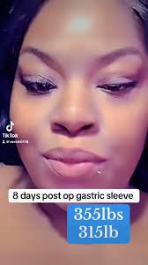 #bariatricsurgery #gastricsleeve #weightloss