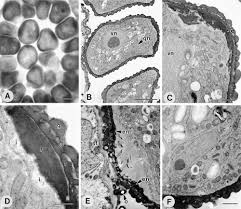 Image result for Hypolytrum goetghebeur