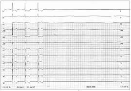 Hearing the doctor tell you that you've got cancer is undoubtedly one of the worst things you may experience. Worsening Dizziness In An Elderly Man Consultant360