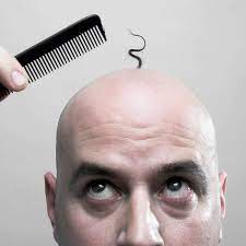 While the natural options are just as diverse as the prescriptive. How Close Is A Cure For Baldness Men S Hair The Guardian