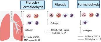 Effects Of Formaldehyde Exposure On The Development Of Pulmonary Fibrosis Induced By Bleomycin In Mice Sciencedirect