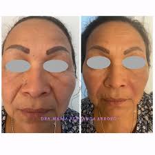 Dra Maria Fernanda Arroyo