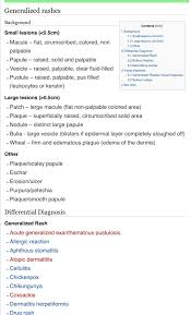Pin By Lisa Rhea On Fnp Diagnosis Fluid Visual